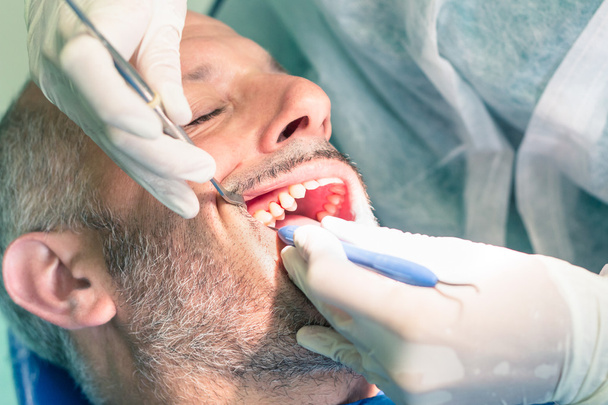Paziente di sesso maschile che soffre durante l'igiene dentale presso lo studio dentistico - Sanguinamento dei denti durante la rimozione della tartara e della placca
 - Foto, immagini