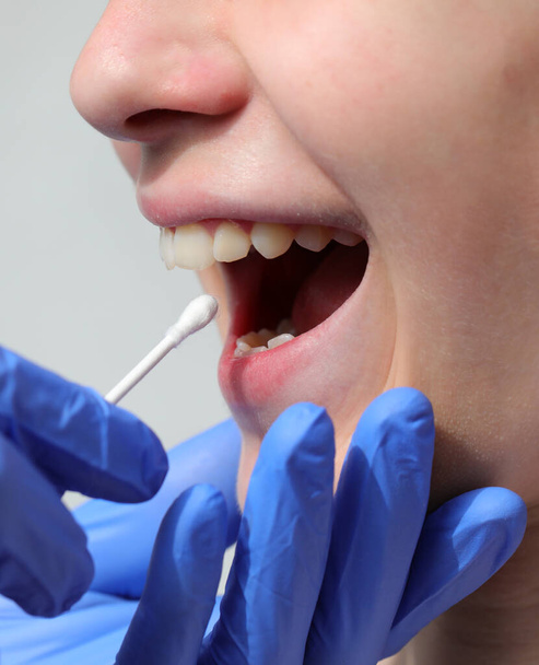 lekarz z rękawicą lateksową przeprowadza wymaz z jamy ustnej i gardła w celu poszukiwania wirusa Covid-19 i dziewczyny z otwartymi ustami - Zdjęcie, obraz