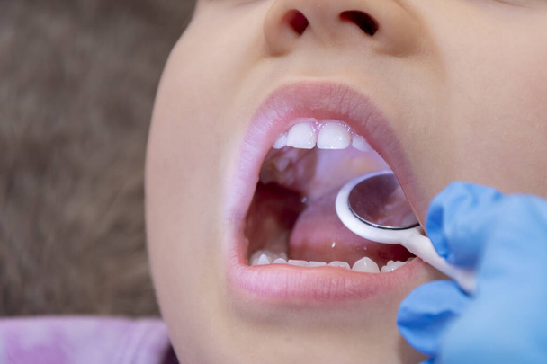 Pediatrinen hammaslääkäri tutkii vauvan hampaita ja suuonteloa, lähikuva, valikoiva keskittyminen. - Valokuva, kuva