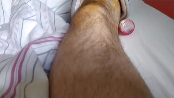 Hombre europeo con ruptura del tendón de Aquiles acostado en la cama del hospital después de la operación con zapato especial y sala de muletas para la rehabilitación médica después de la emergencia - Metraje, vídeo