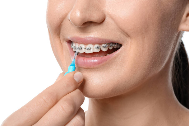 Beyaz arka planda diş telleriyle dişlerini fırçalayan kadın, yakın plan. - Fotoğraf, Görsel