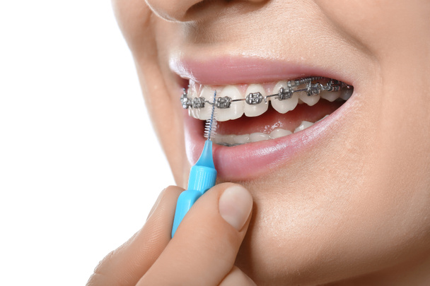 白い背景に歯科用ブレースで歯をブラッシング女性,クローズアップ - 写真・画像