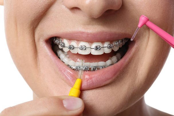Женщина чистит зубы зубными скобками на белом фоне, крупным планом - Фото, изображение