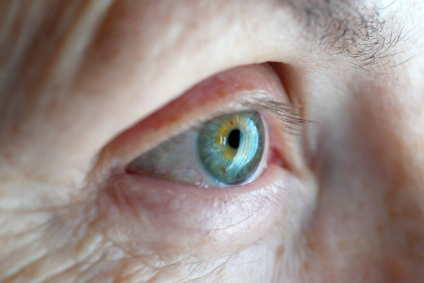 seniorenoog met hangend ooglid en diepe rimpels. Ptosis is een hangende van het bovenste ooglid, lui oog. Cosmetologie en gezichtsopname, closeu - Foto, afbeelding