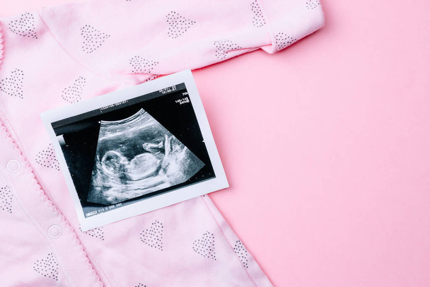 Ultrazvukový snímek těhotného dítěte. Módní roztomilé dětské oblečení s ultrazvukem těhotenství obrázek na růžovém pozadí. Těhotenství, medicína, farmacie, zdravotnictví a lidé koncepce - Fotografie, Obrázek