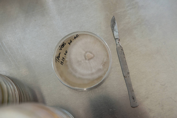 μυκήλιο εξωτικών μανιταριών σε τρυβλίο Petri. Επιλογή και καλλιέργεια μυκηλίου. Καλλιέργεια μανιταριών σε όλο τον κόσμο - Φωτογραφία, εικόνα