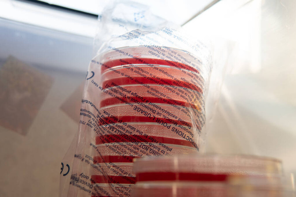 piatti di Petri con agar. Micologia e micelio - Foto, immagini