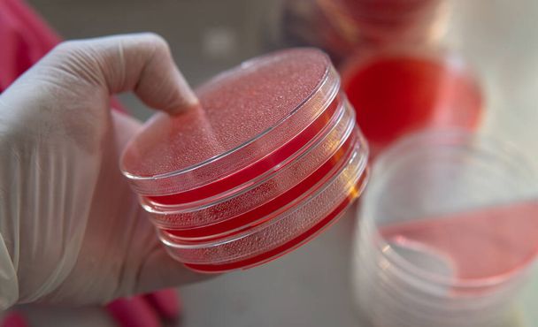 placas de Petri con agar. Microbiología y micelio - Foto, Imagen