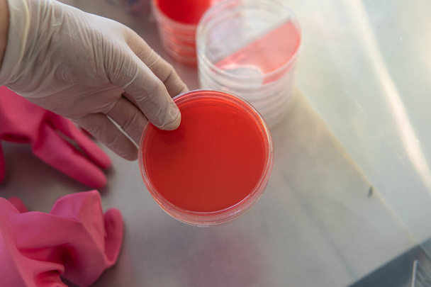 inclinaciones y placas de Petri con agar para investigación. Micología y cultivo de hongos. - Foto, imagen
