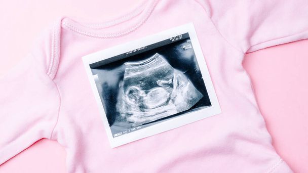Ultrasound picture pregnant baby photo. Fashion cute baby cloth with ultrasound pregnancy image on pink background. Pregnancy, medicine, pharmaceutics, health care and people concept - Photo, Image