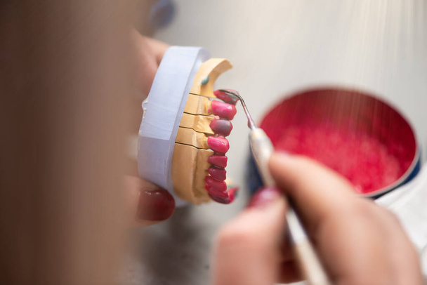Hammasproteesi, tekohampaat, proteesit. Tutkimus ja taulukko hammastyökaluilla - Valokuva, kuva