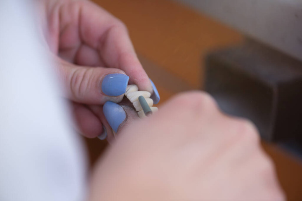Zahnersatz, Prothesen, Prothesen funktionieren. Eine Studie und ein Tisch mit zahnärztlichen Werkzeugen - Foto, Bild