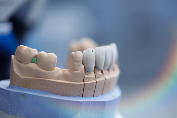 Las prótesis dentales, dentaduras postizas, prótesis funcionan. Un estudio y una mesa con herramientas dentales - Foto, Imagen