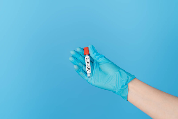 Ručně držící zkumavka s nápisem anémie - Fotografie, Obrázek