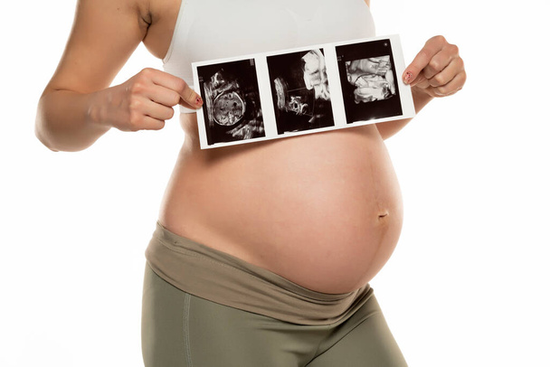 Pregnant woman with ultrasound scan pictures on a white background. - Fotó, kép