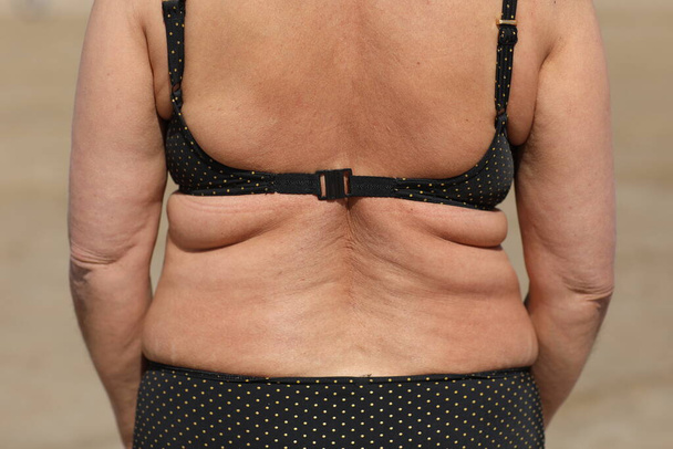 vet vrouw met overgewicht, achteraanzicht, slappe zijkanten en rug met plooien van vet, overgewicht vet lichaam als gevolg van onjuist dieet. Hoge kwaliteit foto - Foto, afbeelding