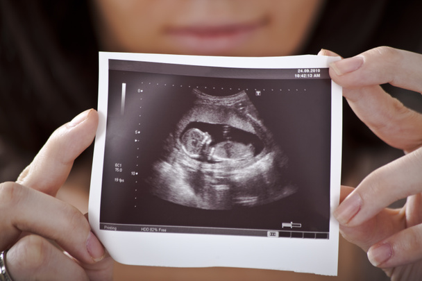 ultrazvuk - Fotografie, Obrázek