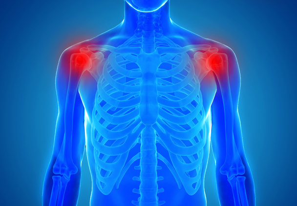 Anatomi insan omuz eklem - yaralanma kavramı - Fotoğraf, Görsel