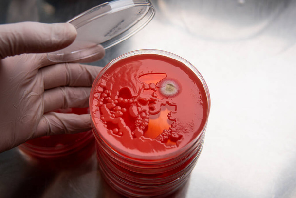 mold and bacteria on red agar. Agar medium for pathogens. Mold spores and mycelium - Photo, Image