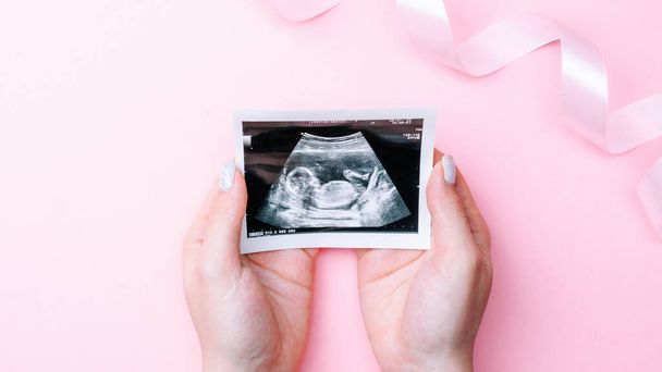 Zdjęcie USG dziecka w ciąży. Dłonie kobiety trzymające ultradźwiękowy obraz ciąży na różowym tle. Pojęcie ciąży, macierzyństwa, oczekiwania na poród dziecka - Zdjęcie, obraz