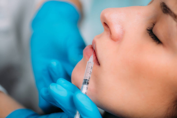 Doctor injecting dermal filler into womans lips  - Foto, imagen