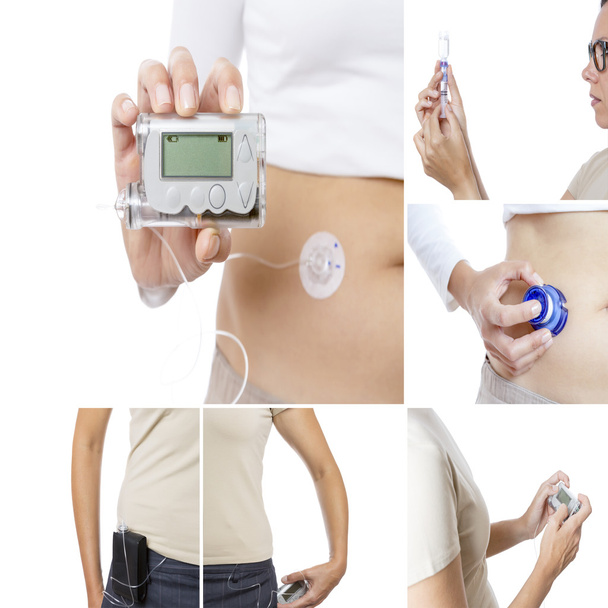 insulin pump collage - Photo, Image