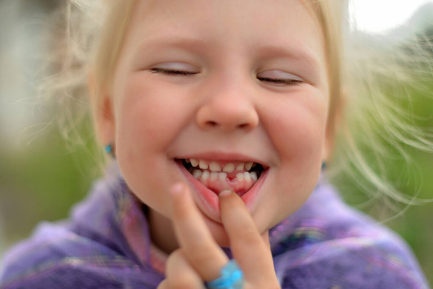Ritratto di una bambina senza un dente da latte. Cambiamento dei denti nei bambini. - Foto, immagini