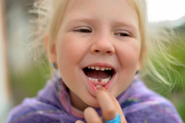 Portrait of a little girl without one milk tooth. Teeth change in children. Dentist - Foto, Bild