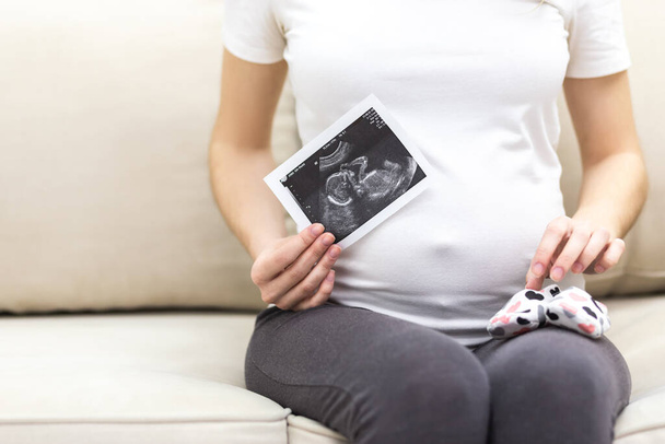 Cropped photo of pregnant woman sitting on the sofa and holding ultrasound report. - Foto, Imagem