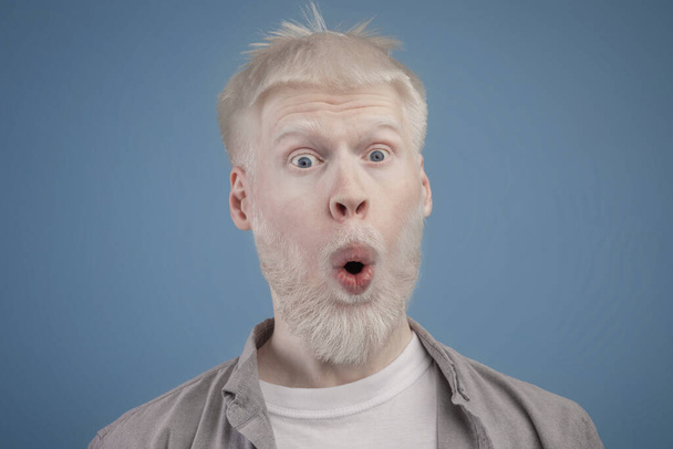 Porträt eines schockierten bärtigen Albino-Typen, der mit weit aufgerissenen Augen und aufgerissenem Mund in die Kamera blickt - Foto, Bild