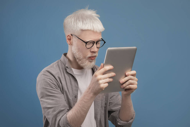 Concept de problèmes de vue. Homme albinos en lunettes regardant l'écran de la tablette et fronçant les sourcils, souffrant d'astigmatisme - Photo, image
