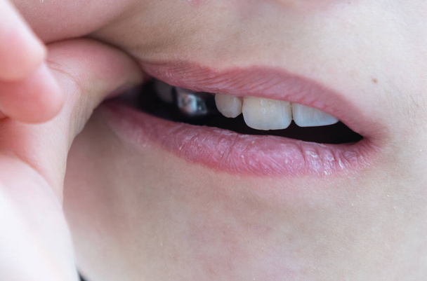 Retrato de niña linda muestra su aparato de ortodoncia sobre un fondo blanco
 - Foto, Imagen