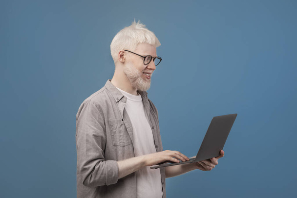 Bilgisayarda çalışan mutlu albino serbest çalışan adam, internette gezinirken bilgisayarını tutuyor, mavi arkaplan - Fotoğraf, Görsel