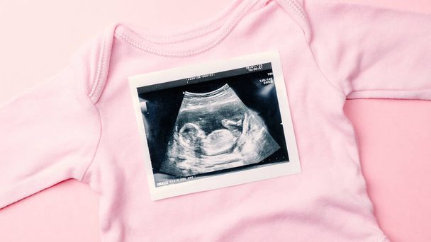 Ультразвукове фото вагітності дитини. Мода мила дитяча тканина з ультразвуковою фотографією вагітності на рожевому фоні. Концепція вагітності, материнства, очікування народження дитини
 - Фото, зображення