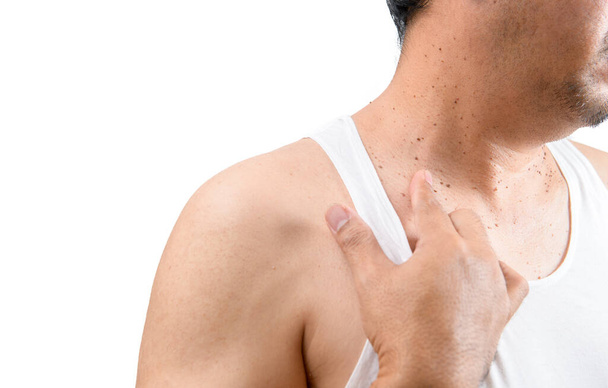 Homme d'âge moyen dans la veine blanche pointent vers des étiquettes de peau ou Acrochordon sur son cou isolé sur fond blanc. Concept de soins de santé - Photo, image