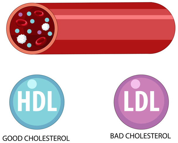 Tipi di colesterolo HDL e LDL illustrazione - Vettoriali, immagini