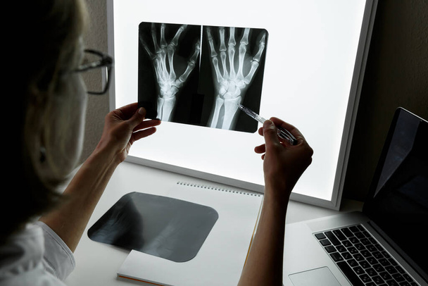 Surgeon Traumatologist  examining an x-ray of the traumatised wrist. Health care and medical insurance concept - Фото, изображение