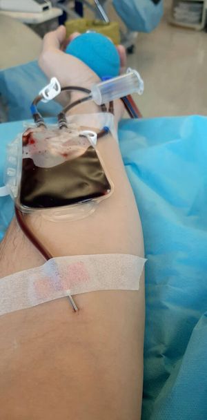 γενναιόδωρος δότης αίματος κατά τη διάρκεια της μετάγγισης στο νοσοκομείο και μια μπάλα στο χέρι για την τόνωση της κυκλοφορίας του αίματος - Φωτογραφία, εικόνα