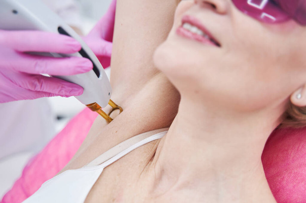 Cosmetologist removing hair from woman armpit with laser device - Foto, Imagem