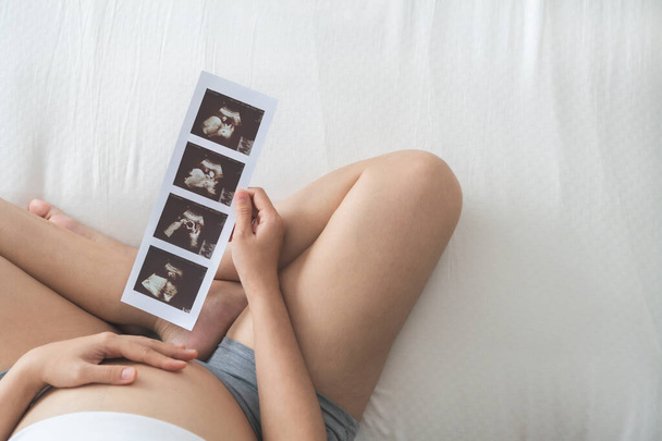 Pregnant woman sitting holding ultrasound scan photo. Asian Mother with sonogram of her unborn baby. Concept of pregnancy, Maternity prenatal care - 写真・画像