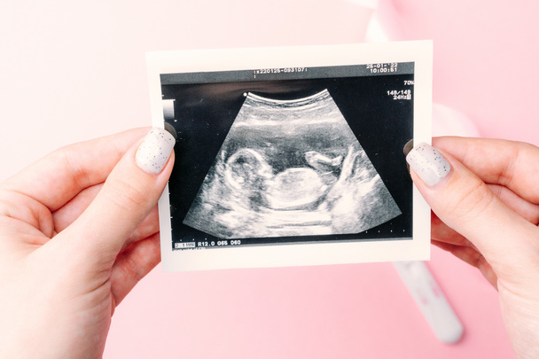 Echografie foto zwanger baby foto. Vrouw handen houden echografie zwangerschap beeld op roze achtergrond. Concept van zwangerschap, moederschap, verwachting voor de bevalling - Foto, afbeelding