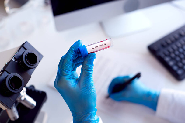 Close Up Of Lab Worker Conducting Research Using Microscope Holding Blood Sample Labelled Type B - Foto, Bild