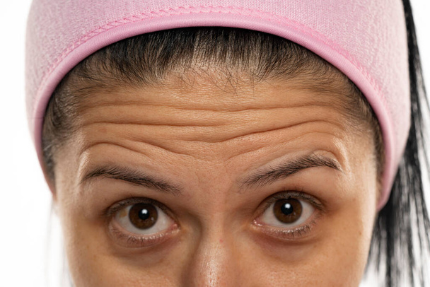 mujer de mediana edad mostrando sus arrugas en la frente sobre un fondo blanco - Foto, imagen
