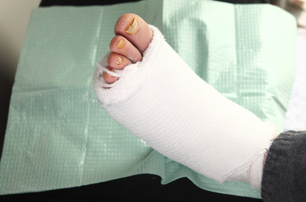 Hombre diabético con infecciones en los pies
 - Foto, Imagen