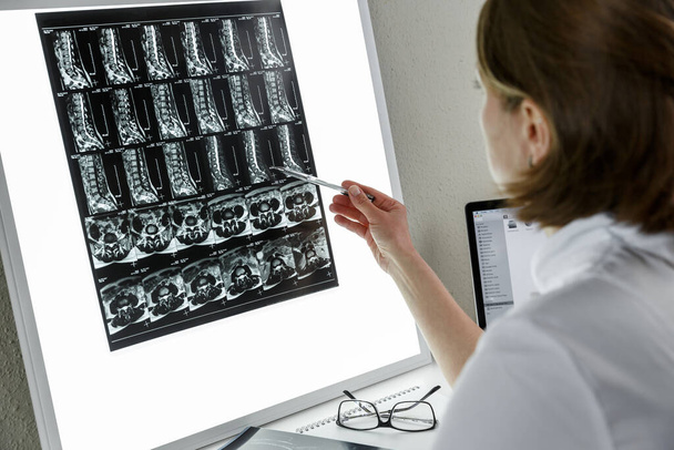 Doctor examining the result of lower spine MRI . Health care and medical insurance concept - Photo, Image