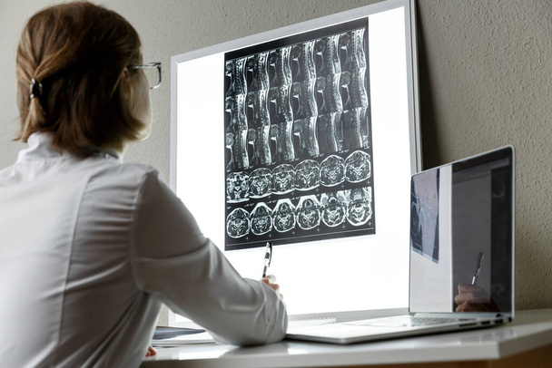 Doctor examining the result of cervical spine MRI . Health care and medical insurance concept - Fotografie, Obrázek