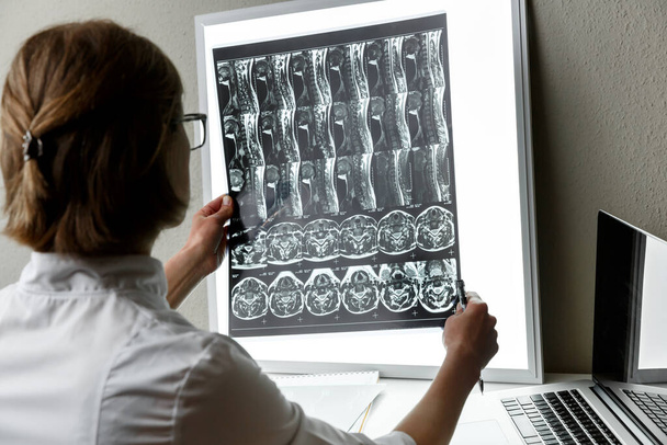 Doctor examining the result of cervical spine MRI.  Health care and medical insurance concept - Fotoğraf, Görsel