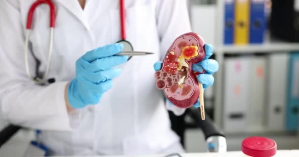 Médico urólogo y nefrólogo sostiene modelo de riñón - Metraje, vídeo