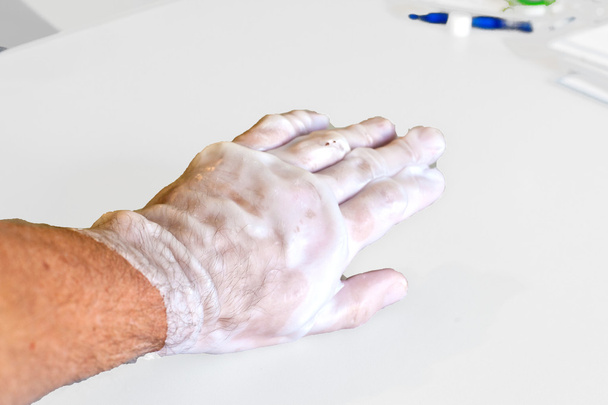 Käsi fysioterapia palauttaa rikki löytäjä
 - Valokuva, kuva