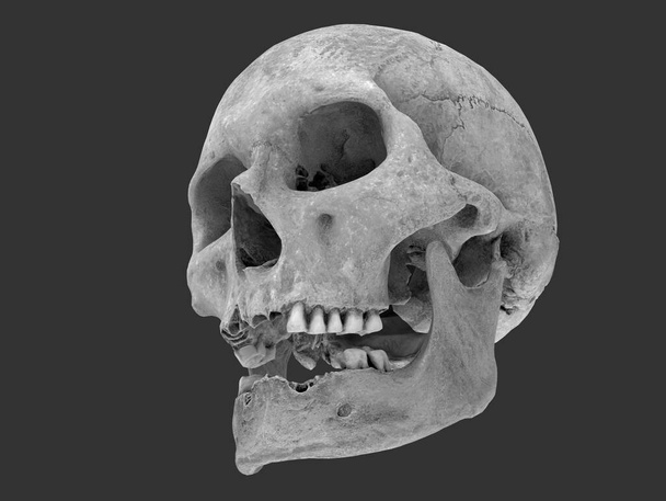 Alter Schädel mit gebrochenen Zähnen - flache Aufnahme - 3D Illustration - Foto, Bild